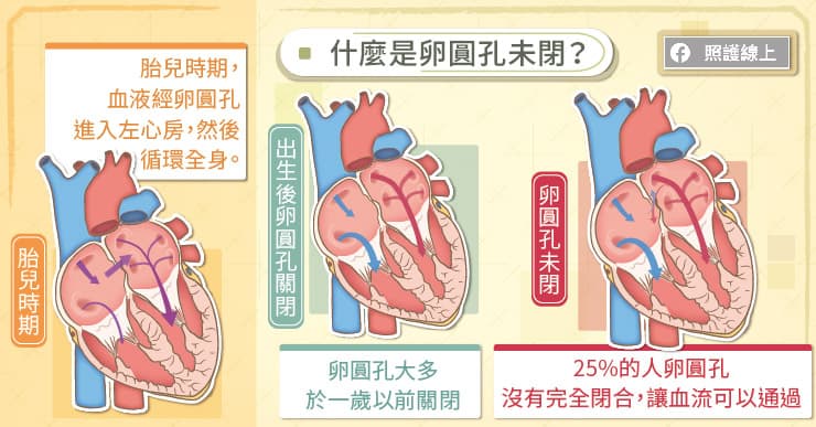 心臟