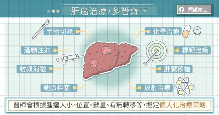 治療肝癌,多管齊下