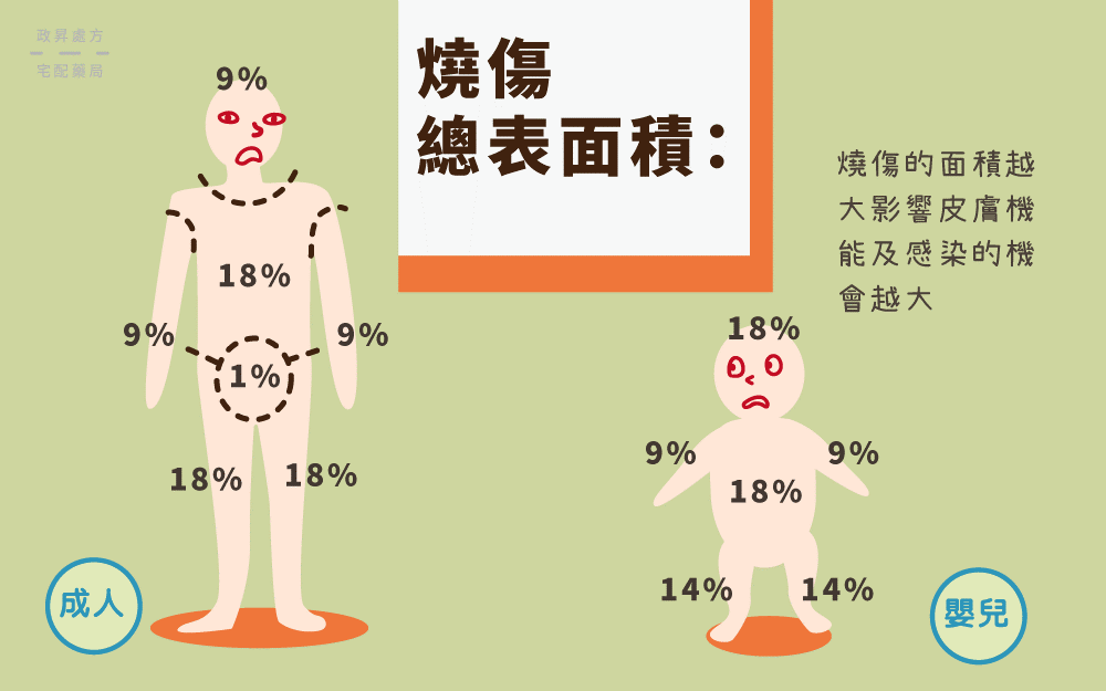 燒燙傷面積