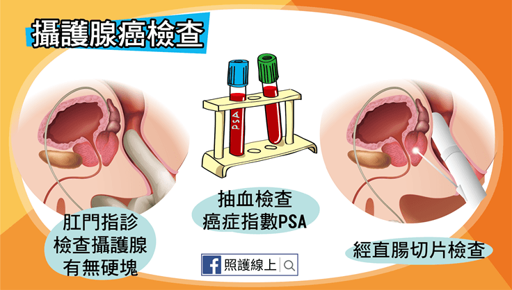 攝護腺