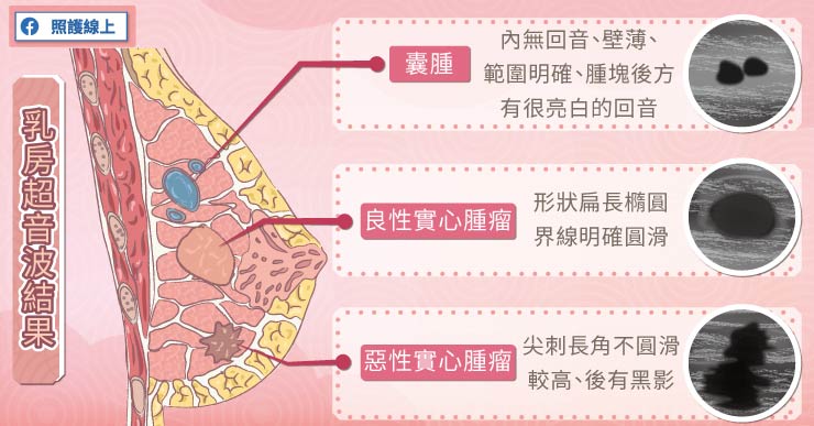 乳房