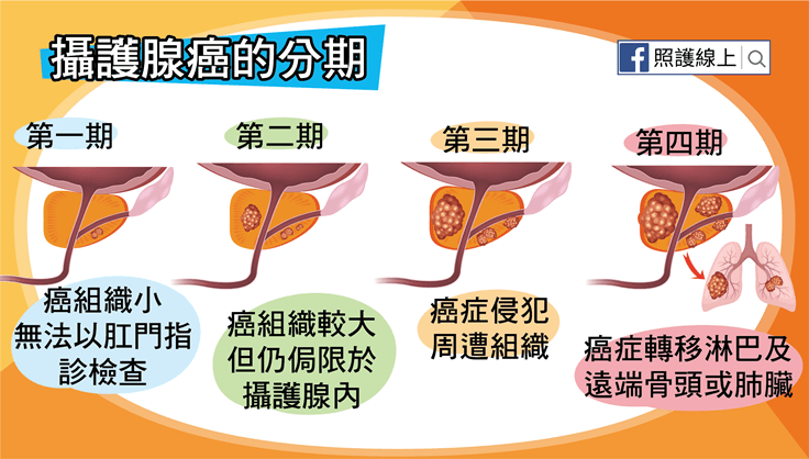 攝護腺