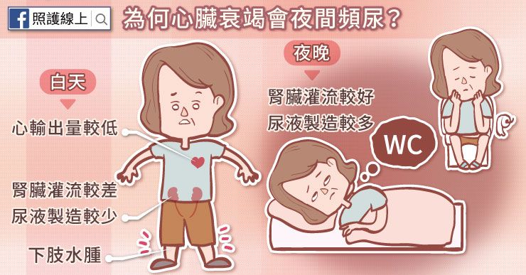 心臟衰竭