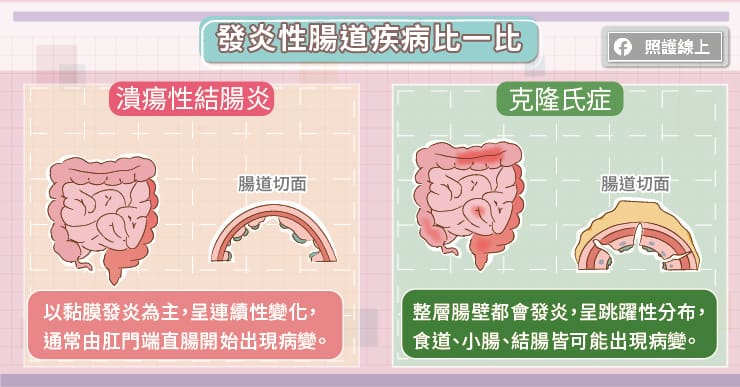 腸道