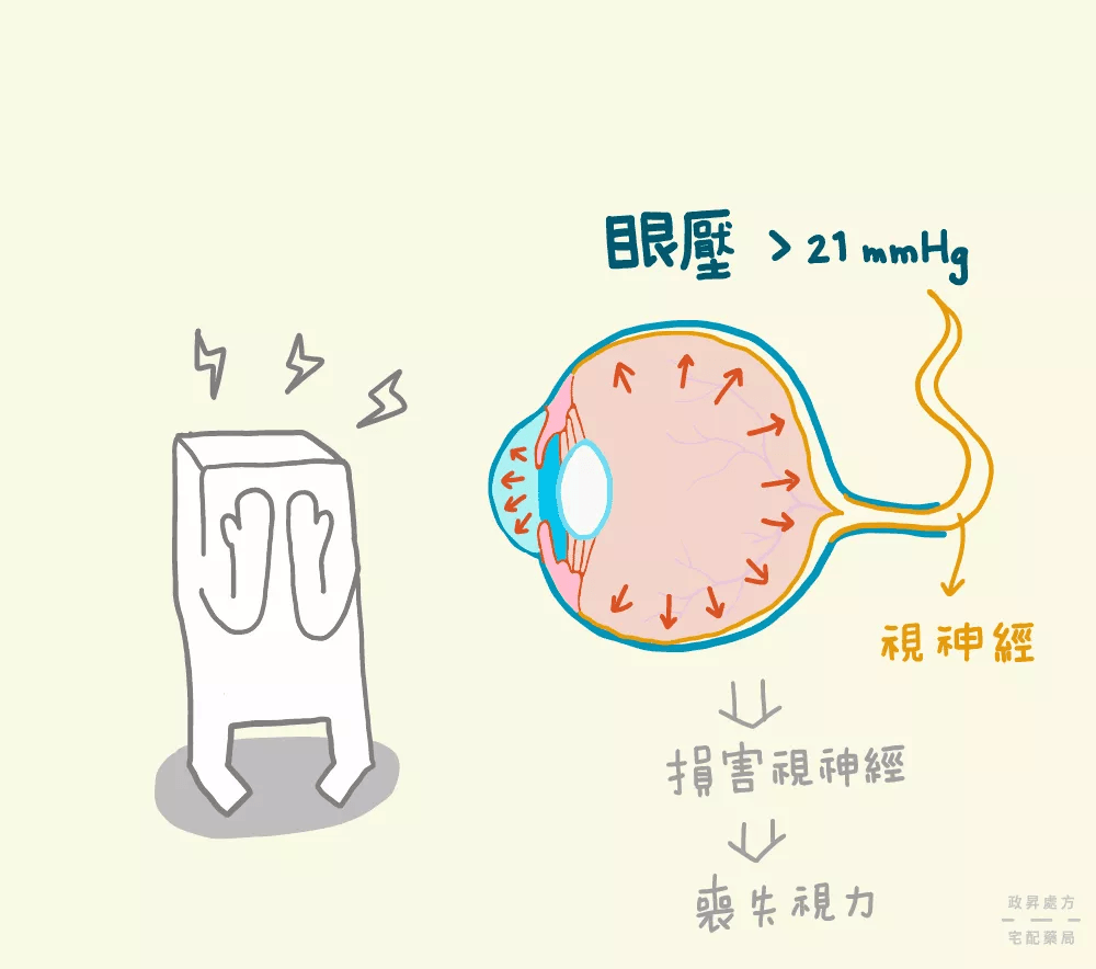 青光眼