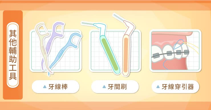 其他潔牙輔助工具