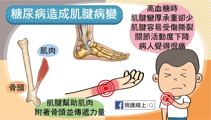 肌腱