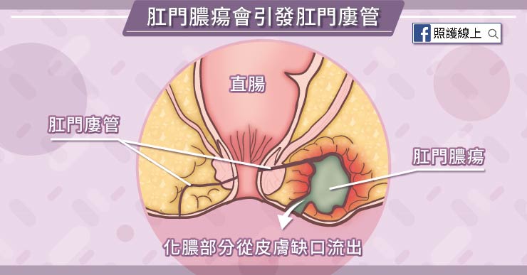 肛門