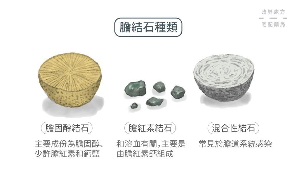 膽固醇