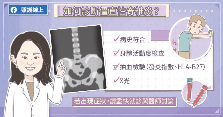 脊椎