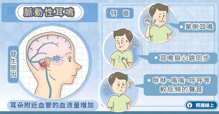 持續不斷,非常擾人的脈動性耳鳴