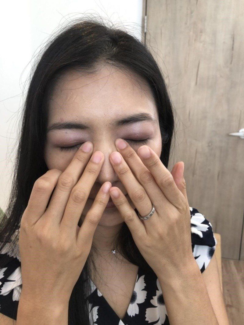 老花眼