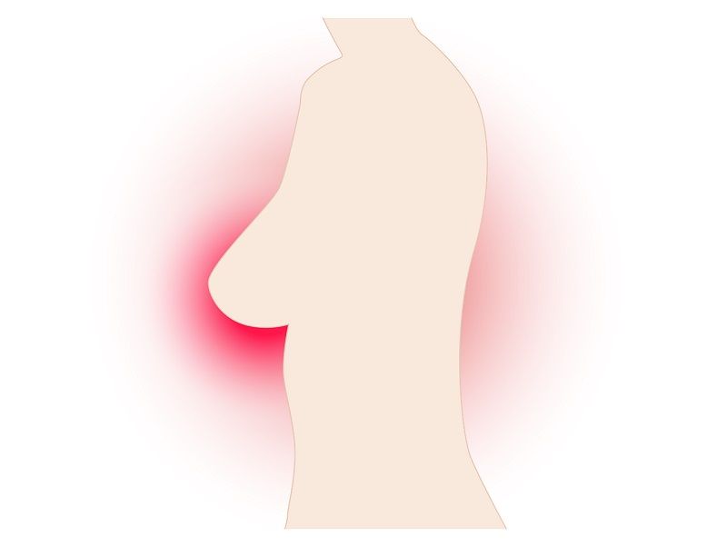 除了乳房 X 光攝影檢查、乳房超音波檢查,若要早期發現乳癌,有沒有實行上更簡便快速、準確率又高的方法?(圖/Pixabay)
