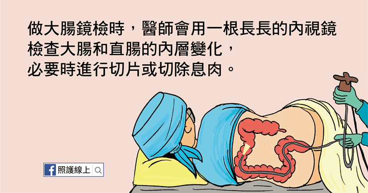 大腸鏡