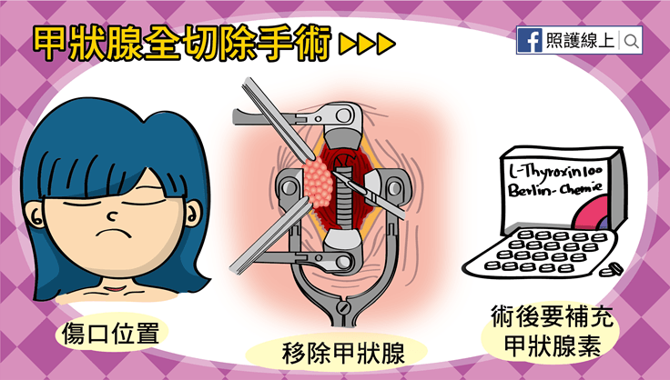 癌症