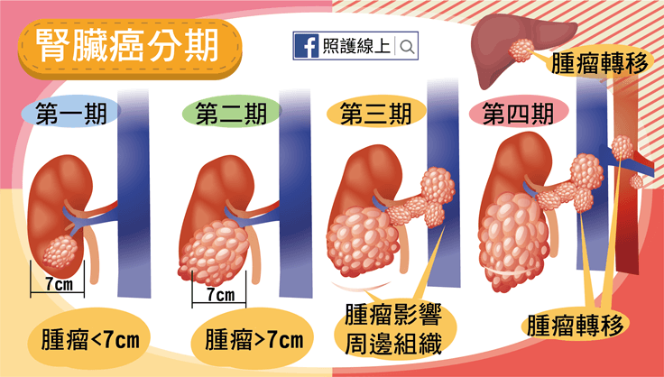 腎臟