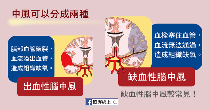 中風