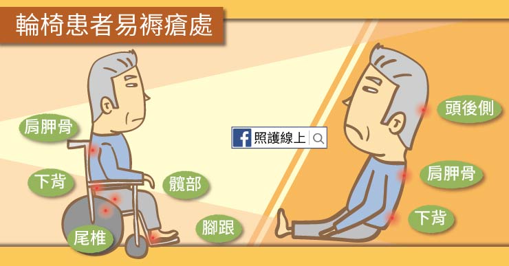 褥瘡