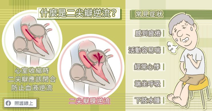 心臟