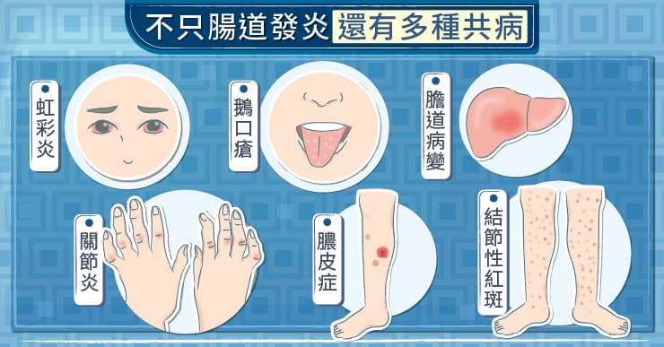 腸道