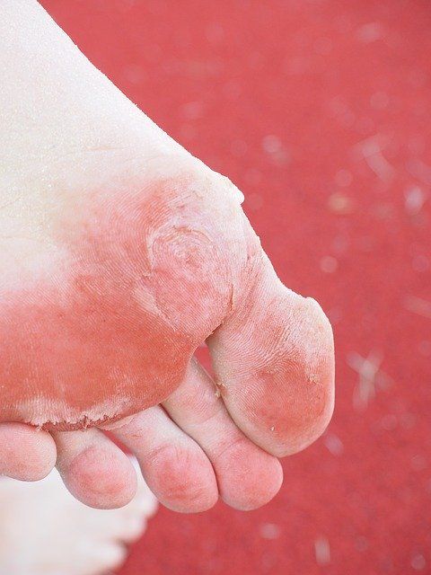 足部