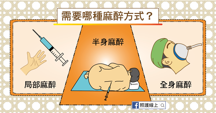 麻醉