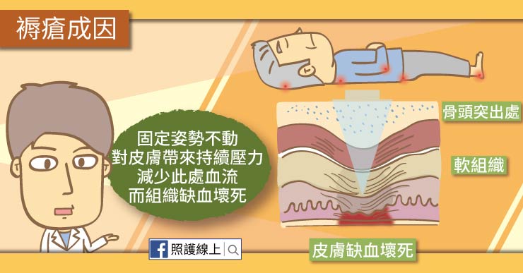 褥瘡