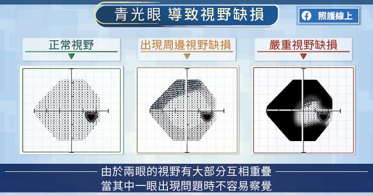 青光眼
