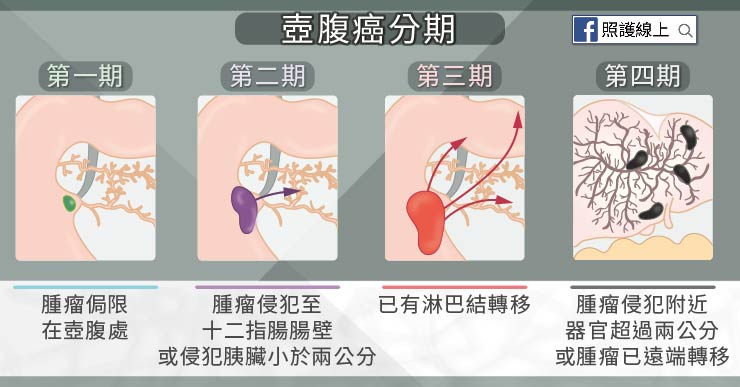腫瘤