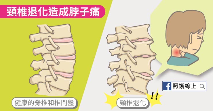 脖子痛