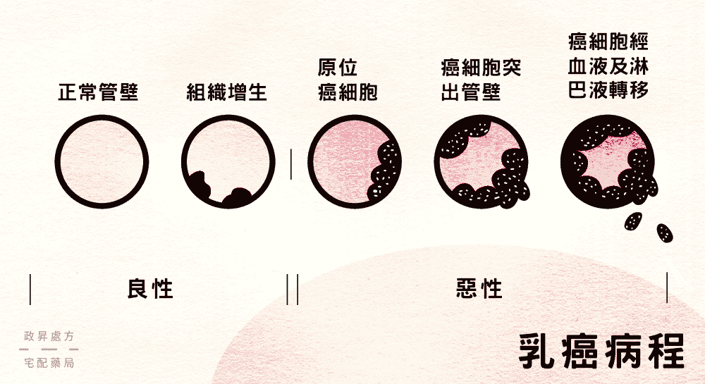 惡性腫瘤