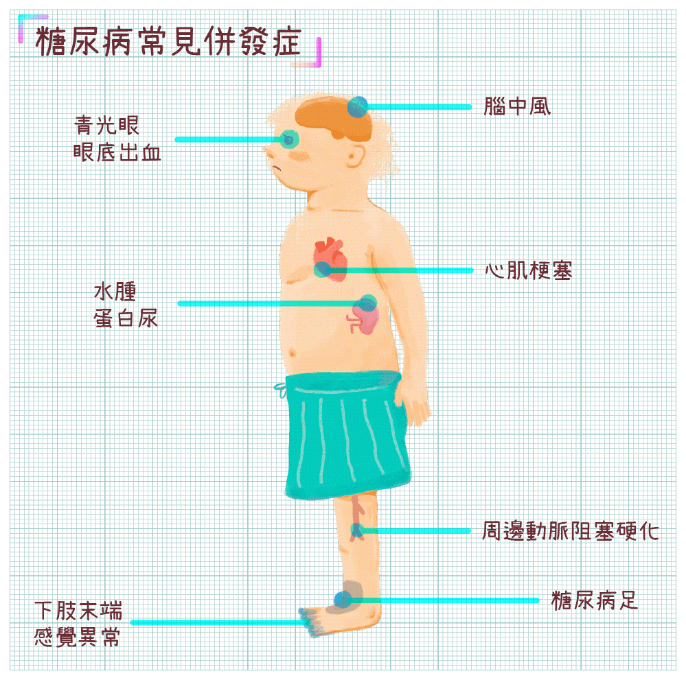 糖尿病併發症