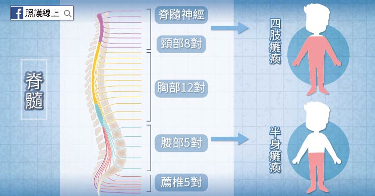 脊隨損傷