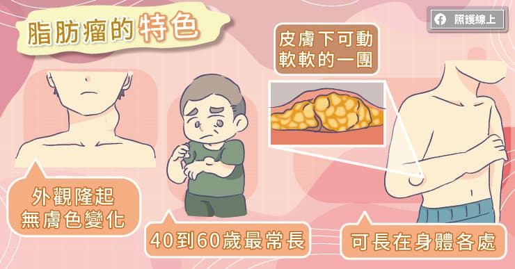 脂肪瘤