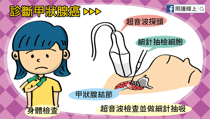甲狀腺癌