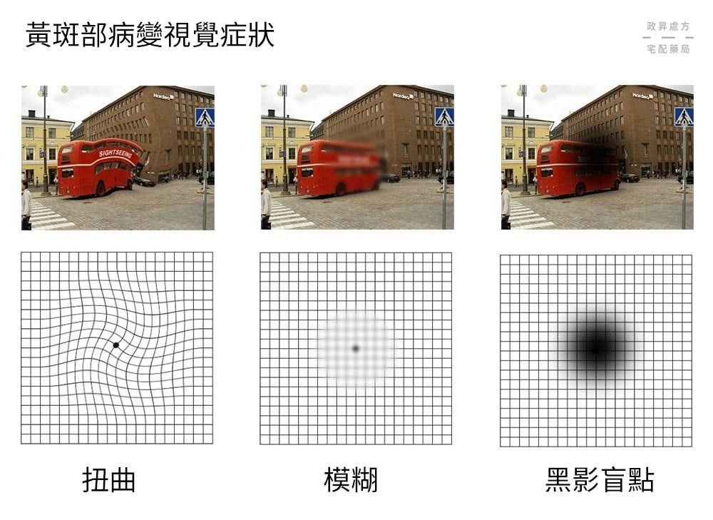 視線模糊