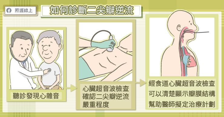 心臟