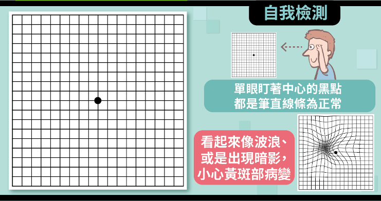 黃斑部病變