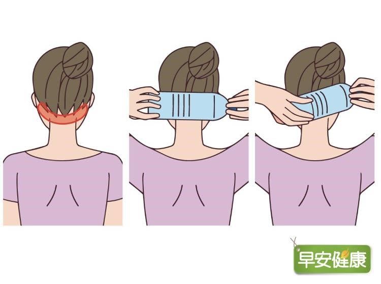 肌肉僵硬