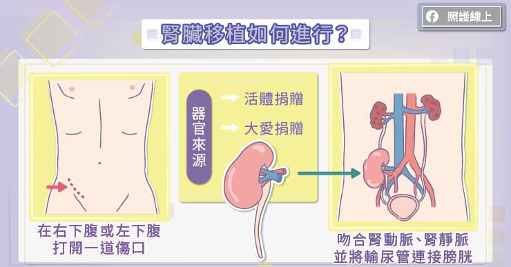 腎臟