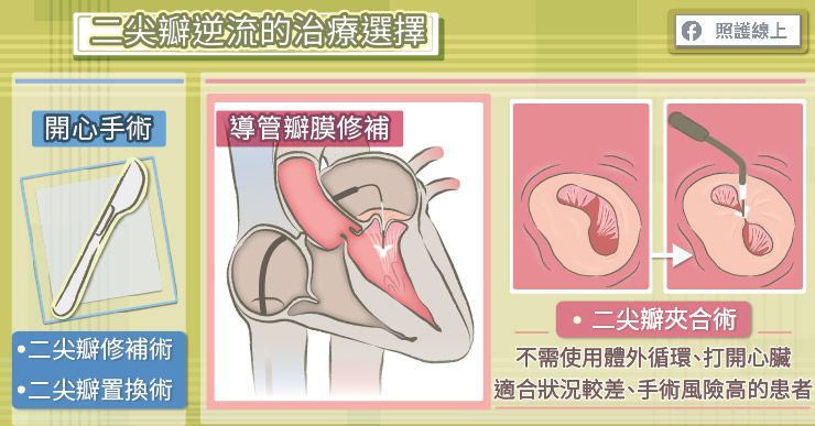 心臟