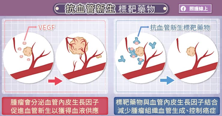 抗血管新生標靶藥物