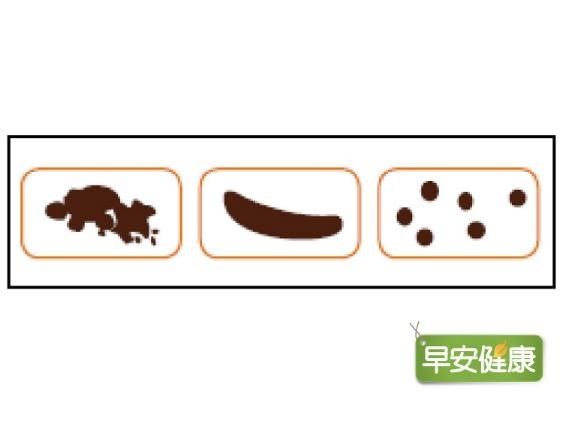 便秘