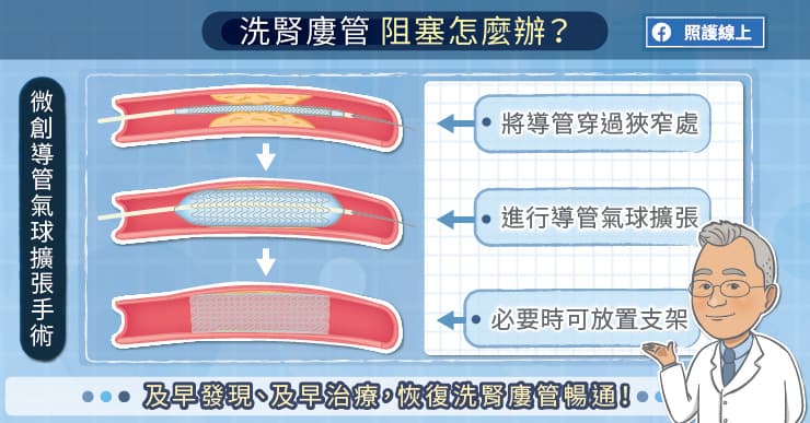 洗腎