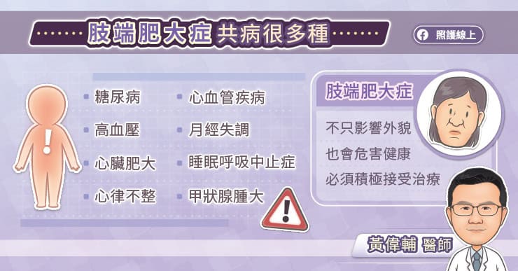 肢端肥大症共病很多種