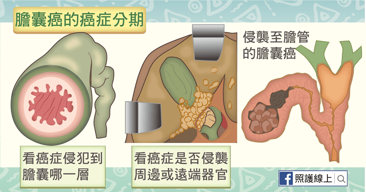 癌症