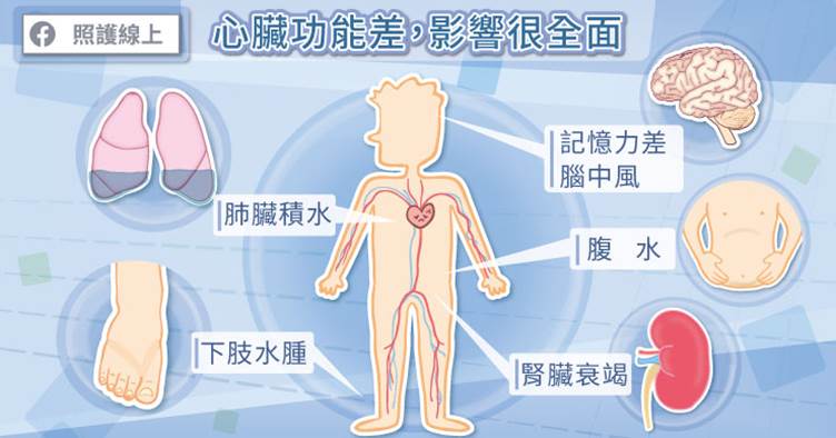 心衰竭