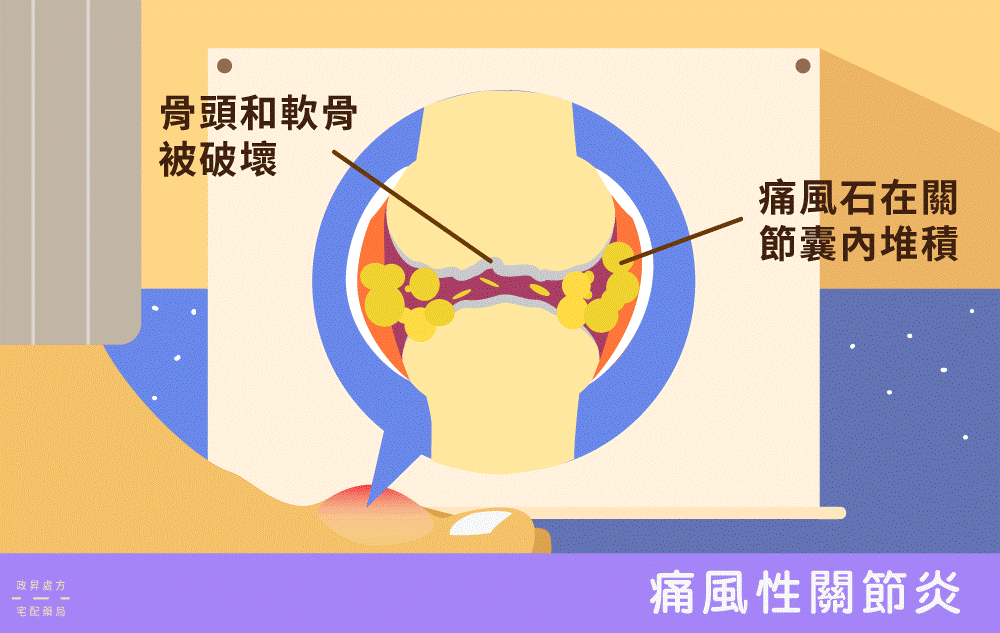高普林