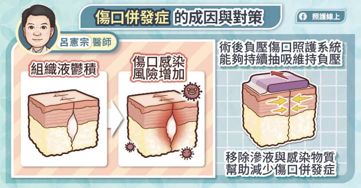 傷口併發症的成因與對策