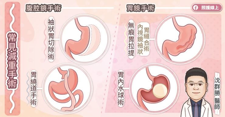 常見的減重手術
